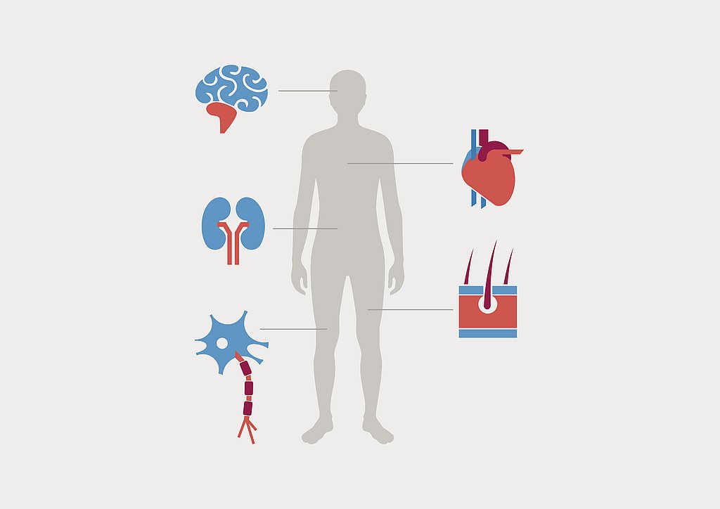 Therapeutic apheresis offers a wide range of applications