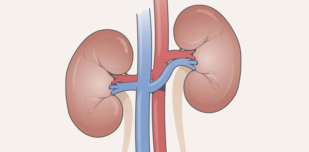 Enfermedad Renal