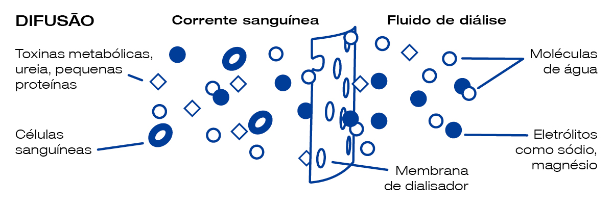 Como é que a diálise remove os resíduos e as toxinas do organismo