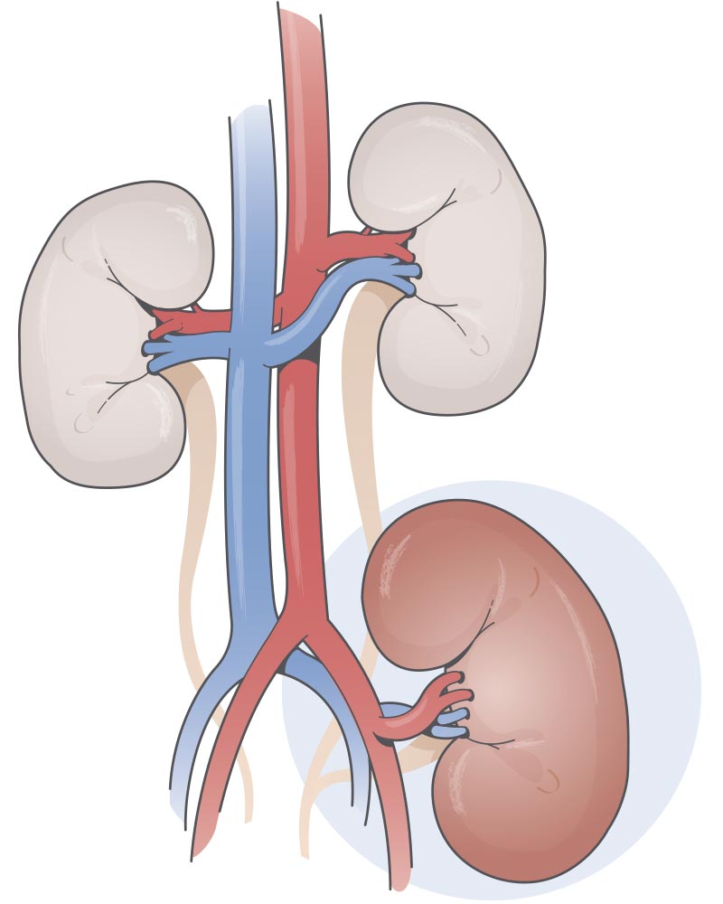 transplantation.jpg