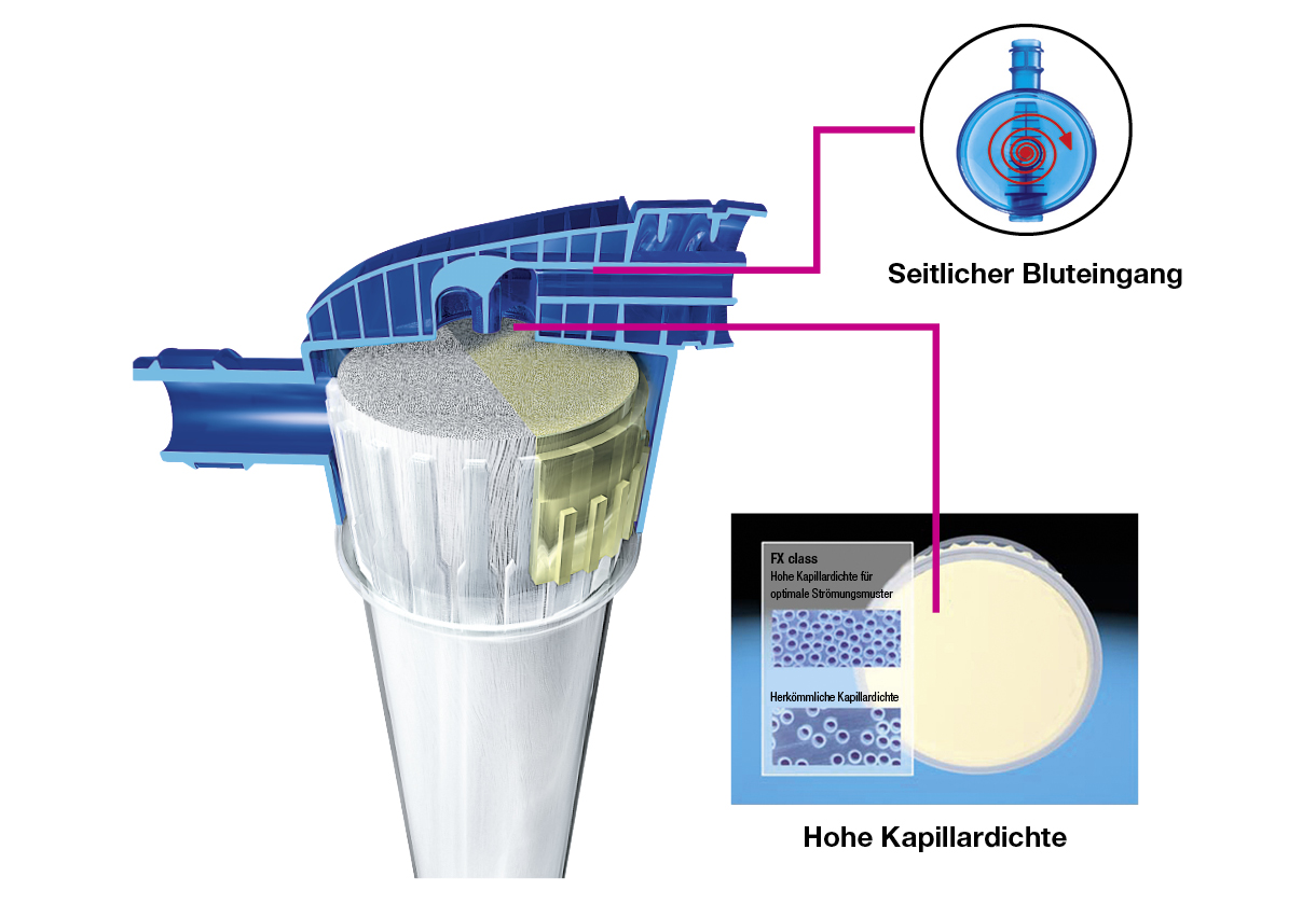 Die Gehäuseausführung der FX-class® Dialysatoren ist für effektive Blutflussbedingungen optimiert worden