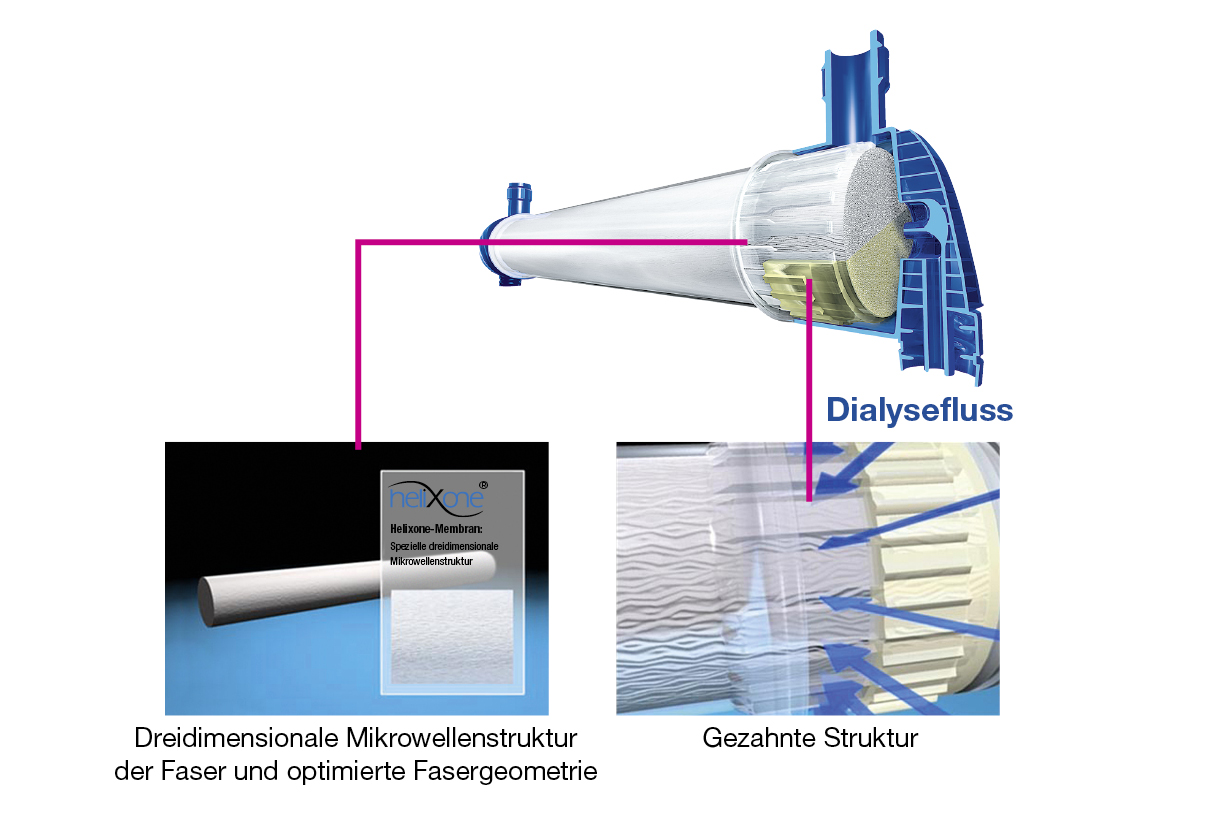 Design der FX-class®-Dialysatoren