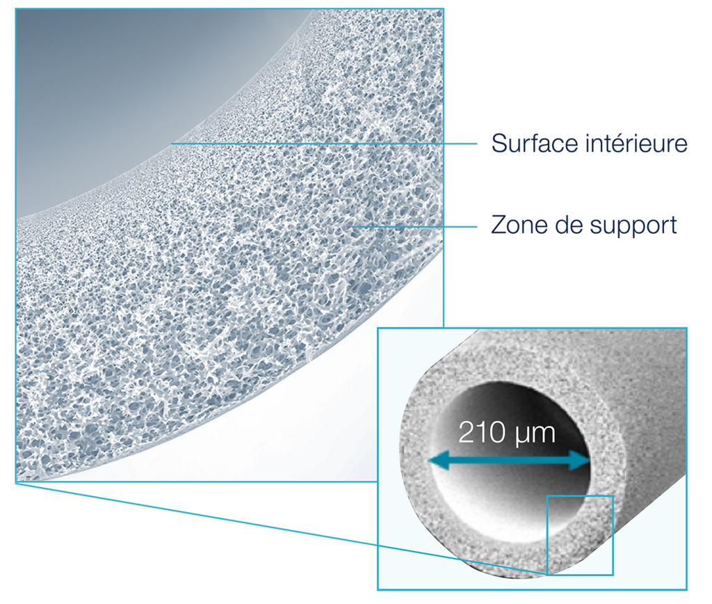 Fibre de dialyseur HDF FX CorAL