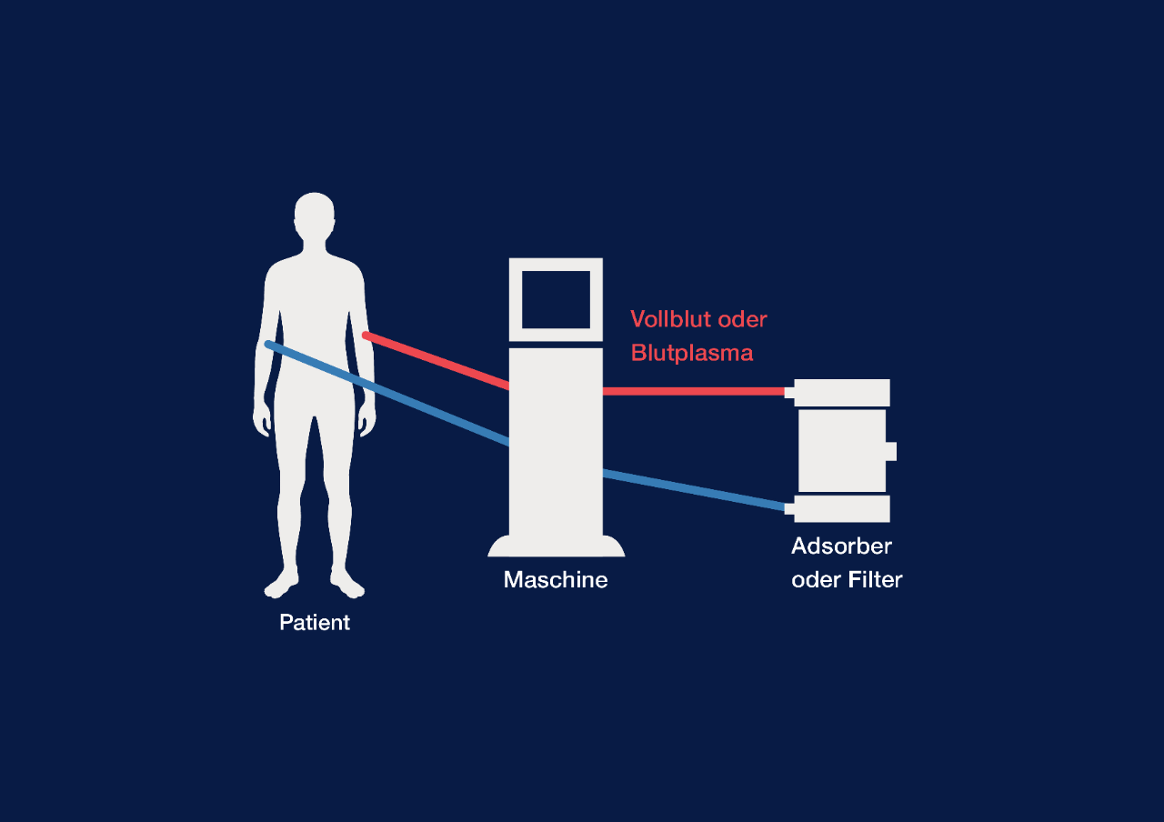 TA_Therapeutic_Apheresis_graphic2DE