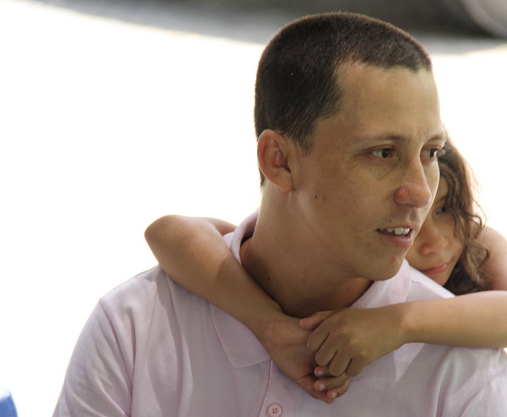 Diálisis Peritoneal como una opción de vida