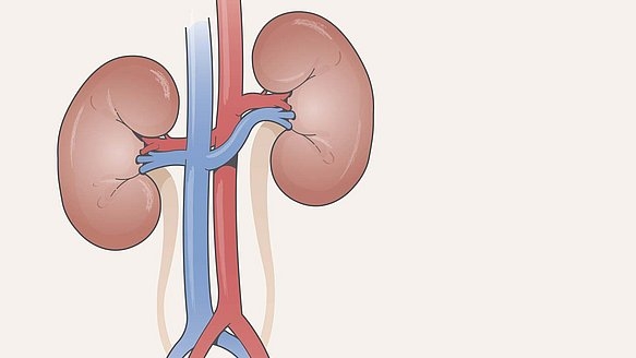 Enfermedad Renal
