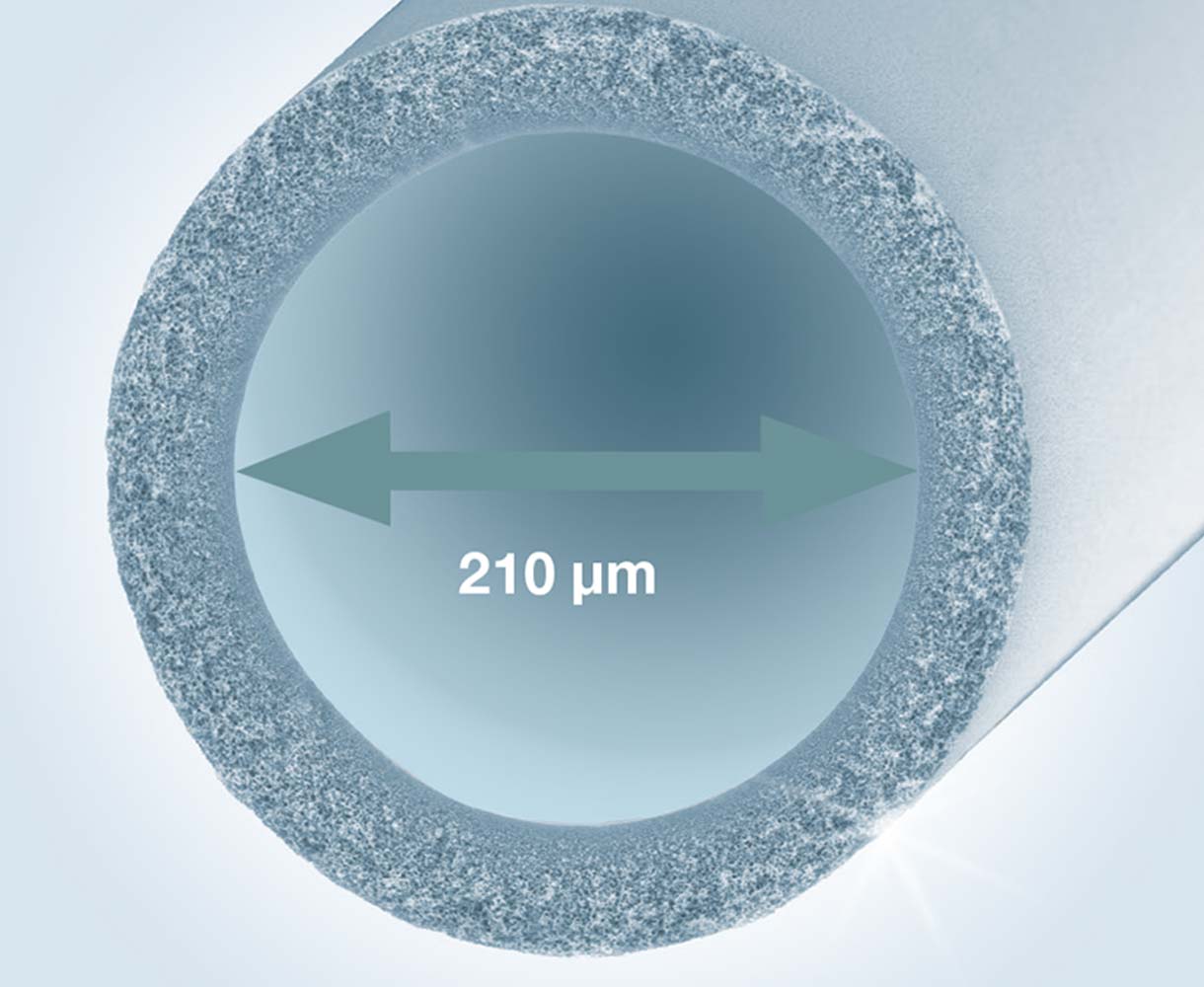 Lumen kapiláry hemodiafiltrů FX CorDiax o velikosti 210 μm zajišťuje optimální průtok krve dialyzátorem a maximální účinnost terapie HighVolumeHDF.