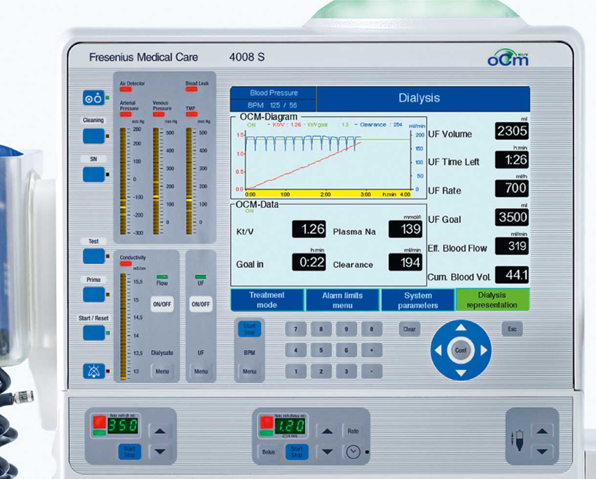 OCM® – Online Clearance Monitor