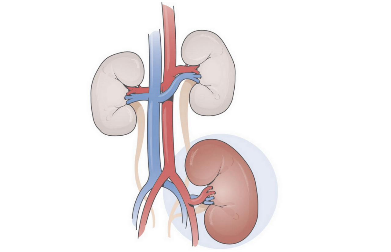 _transplantation_50-50_