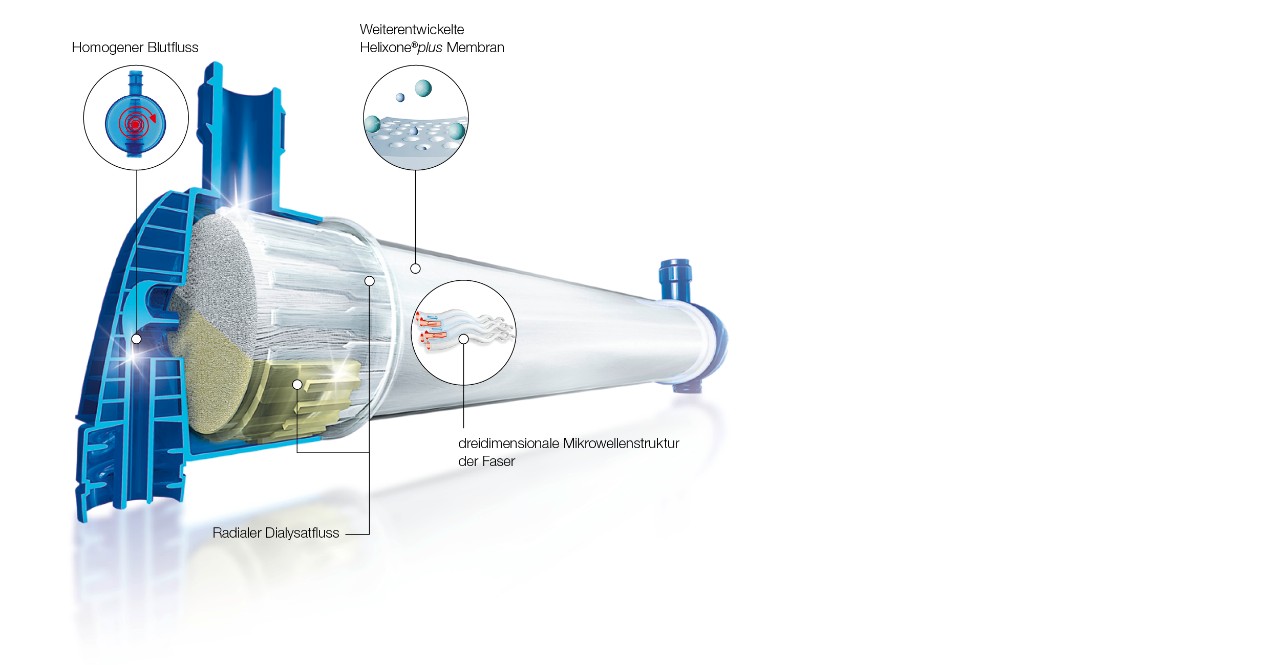 FX-class dialyzers design