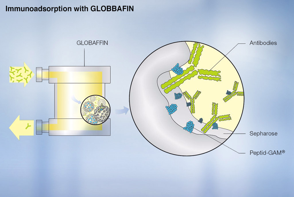 GLOBAFFIN — efficient and selective autoimmune disease treatment