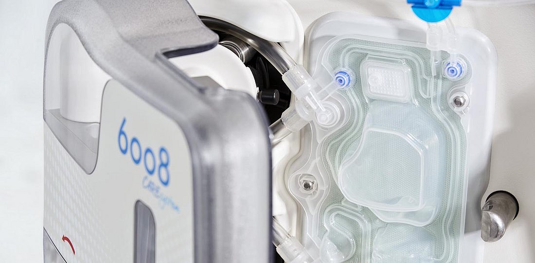 Images of machines and systems for dialysis treatments