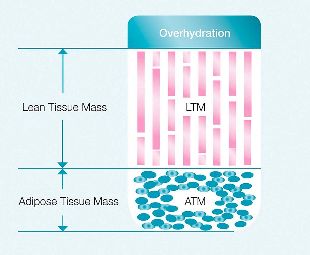 Body composition model adapted from Chamney 2007
