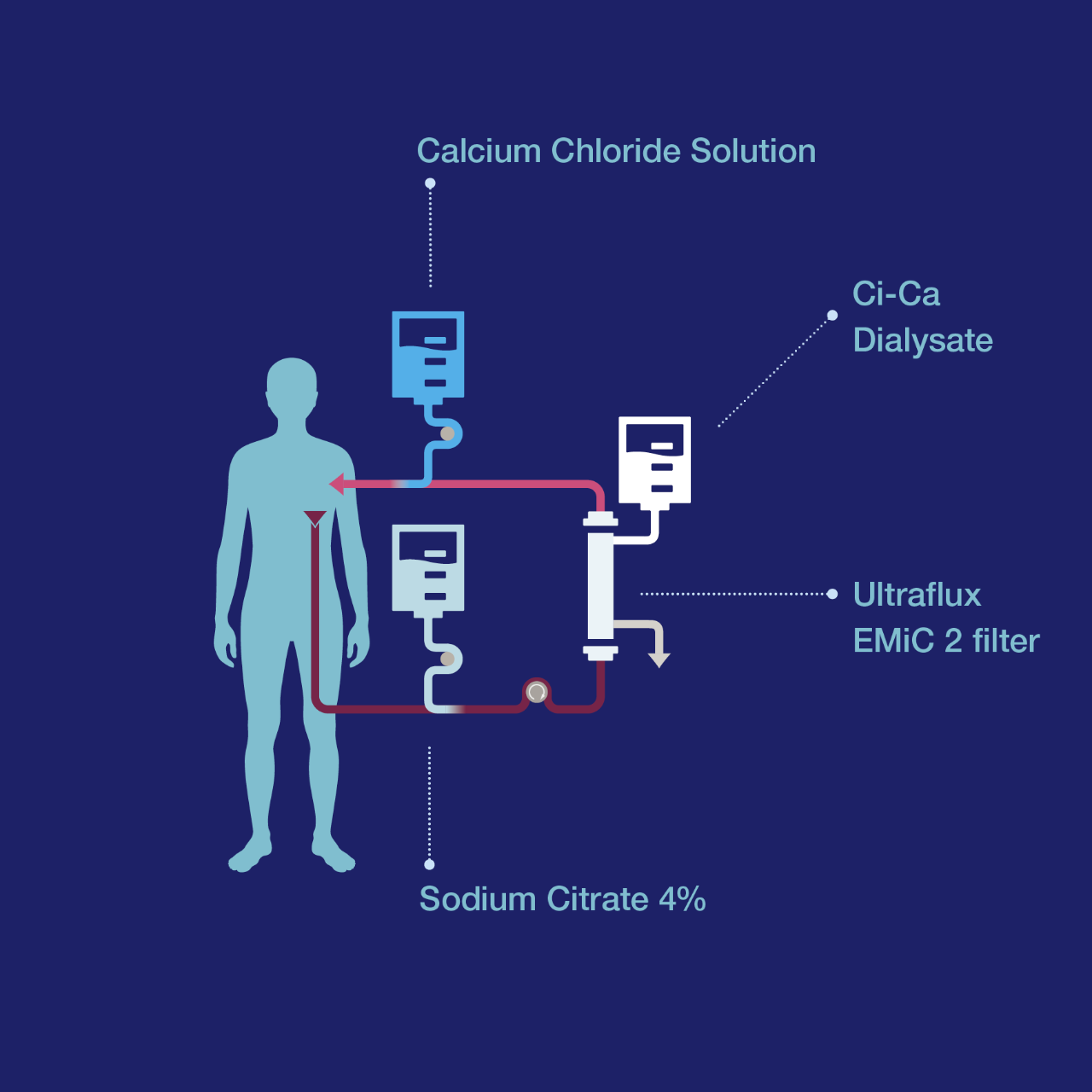 Continuous kidney replacement therapy (CKRT)