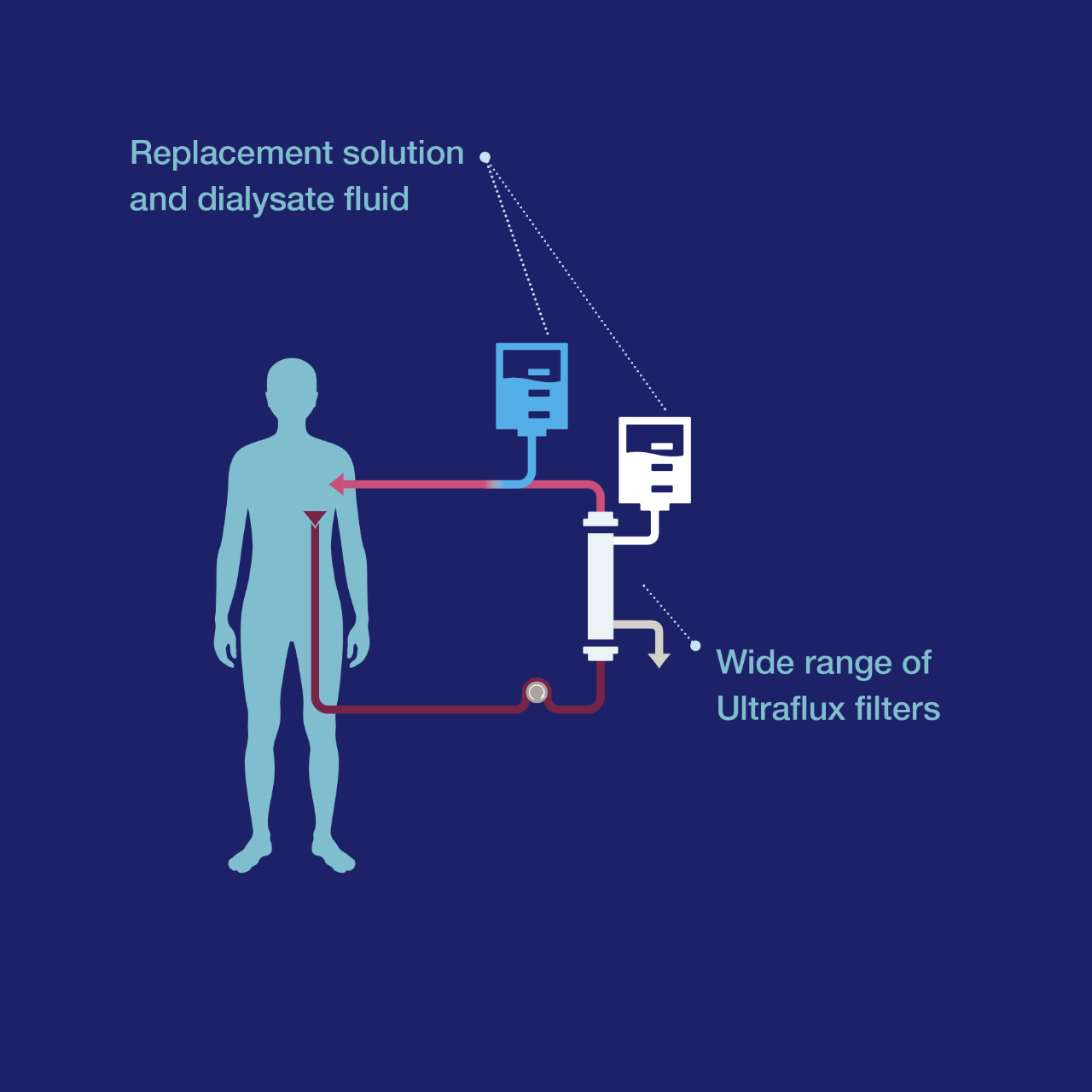 Continuous kidney replacement therapy (CKRT)