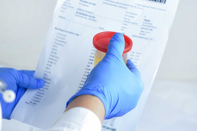 Urine test