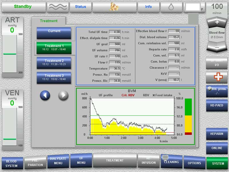 Blood Volume Monitor