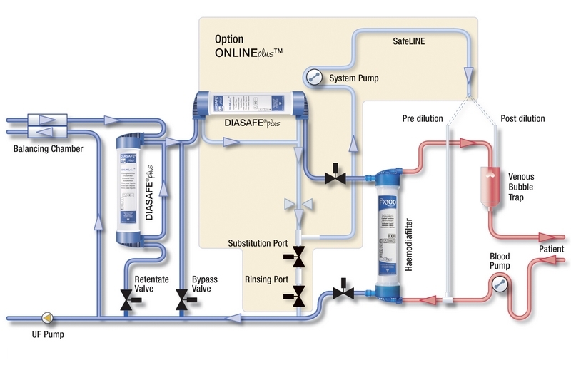DIAFIX-lock-system