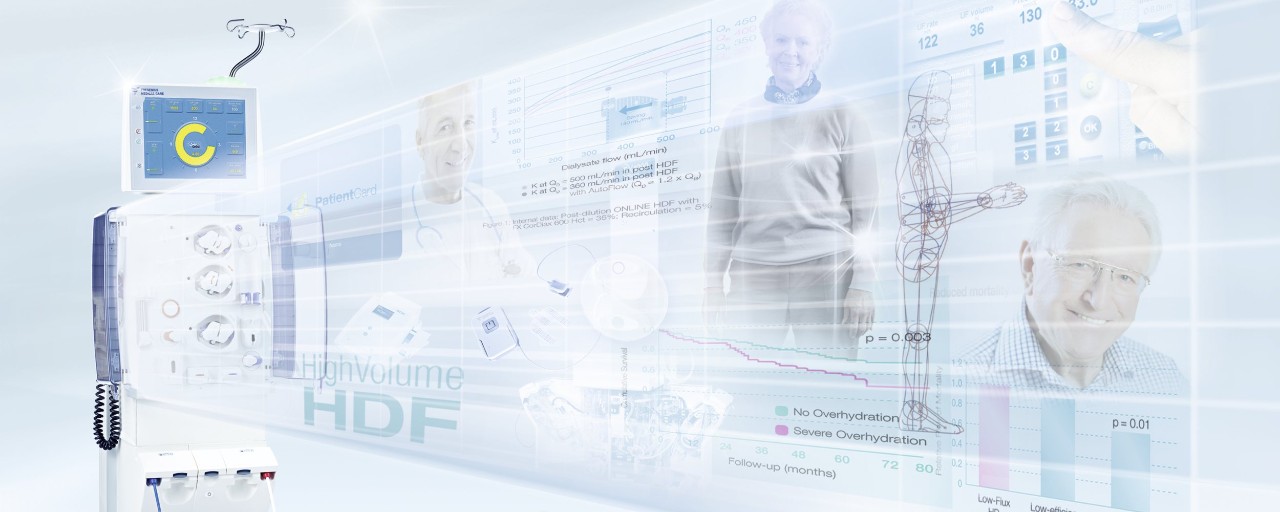 HighVolumeHDF es Fresenius Medical Care