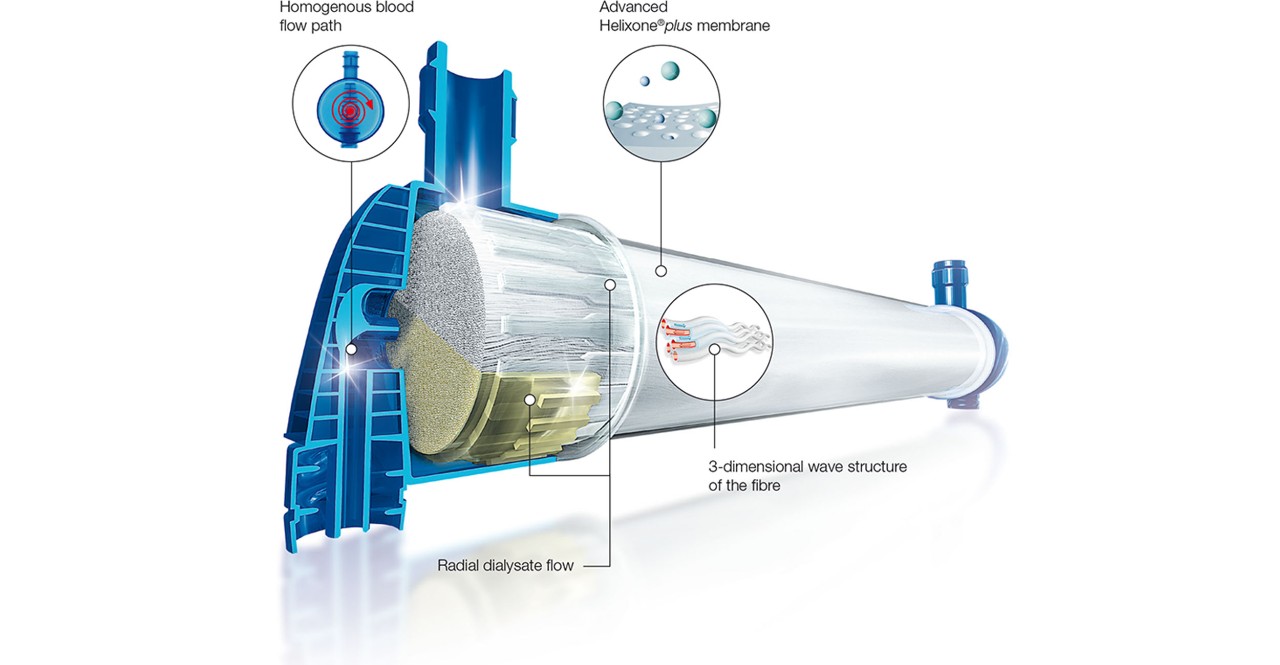 FX-class dialyzers design